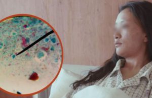 24-Year-Old Woman Suffers Stomach Perforation Due to One Common Morning Coffee Mistake