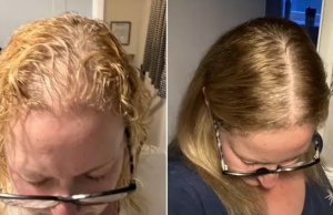 Sh0cking before-and-after photos show what common supplement is capable of